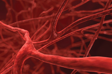 Лечение варикоза у мужчин