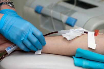 Сделать коагулограмму в Киеве