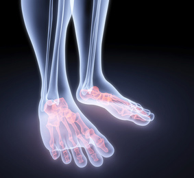 Компьютерная томография (КТ) нижних конечностей