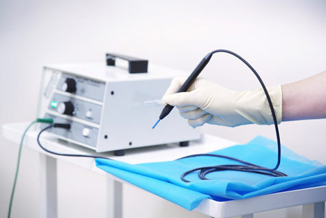 Радиоволновое удаление сосудистых звездочек Киев