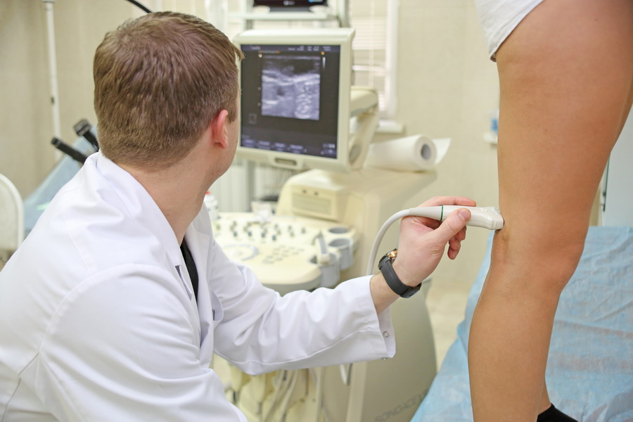 УЗИ с доплером Киев (флебология)