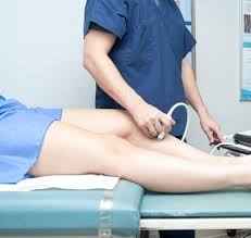 Ультразвуковое исследование сосудов нижних конечностей