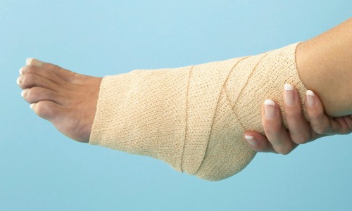 Хирургическое лечение атеросклеротических поражений артерий Киев