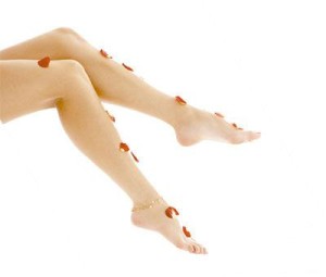 Гирудотерапия в лечении сосудистых заболеваний ног