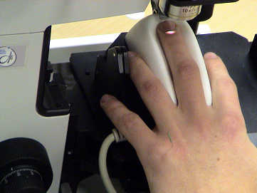 Капилляроскопия (методика проведения)