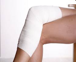 Флебэктомия лечение