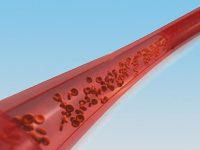 Тромбы в венах ног