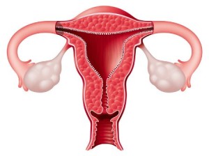 Гинекологические заболевания. Современные методы удаления полипа цервикального канала. Прием врача гинеколога в Киеве. Диагностика гинекологических заболеваний – УЗИ малого таза в Киеве, видеокольпоскопия Киев, ПЦР тест, цистоскопия мазка влагалища и шейки матки