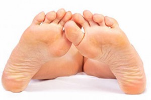 Симптомы подошвенных бородавок