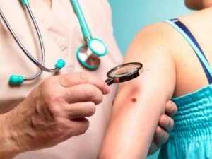 Как берут соскоб с родинки? (Гистология родинки перед удалением, гистология после удаления родинки, почему нельзя делать биопсию родинки, биопсия родинки цена).