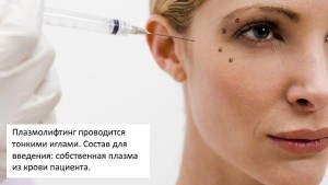 Плазмолифтинг вокруг глаз, плазмолифтинг количество процедур(плазмолифтинг отзывы). Плазмолифтинг при акне, плазмолифтиг от прищей - плазмотерапия лица