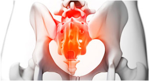 Признаки кокцигодинии