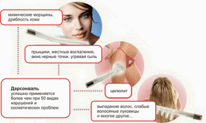 Дарсонвализация лица 